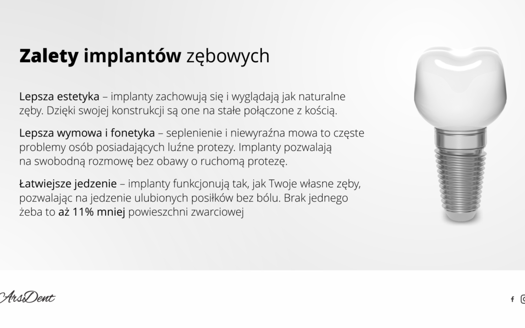 Zalety implantów zębowych