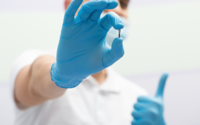 Jak przebiega proces gojenia implantów dentystycznych?
